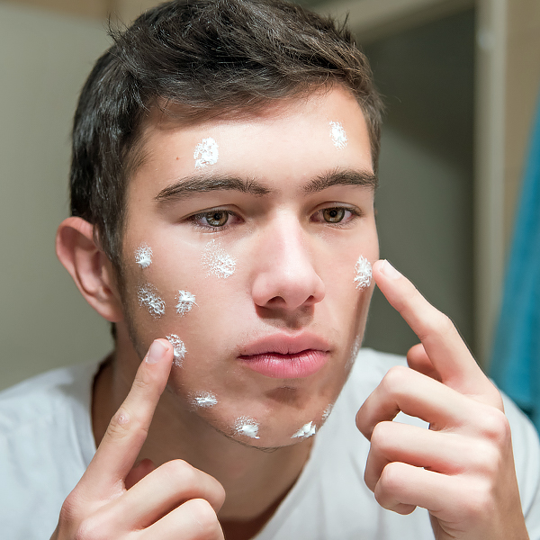 A young man applying topical cream to his face