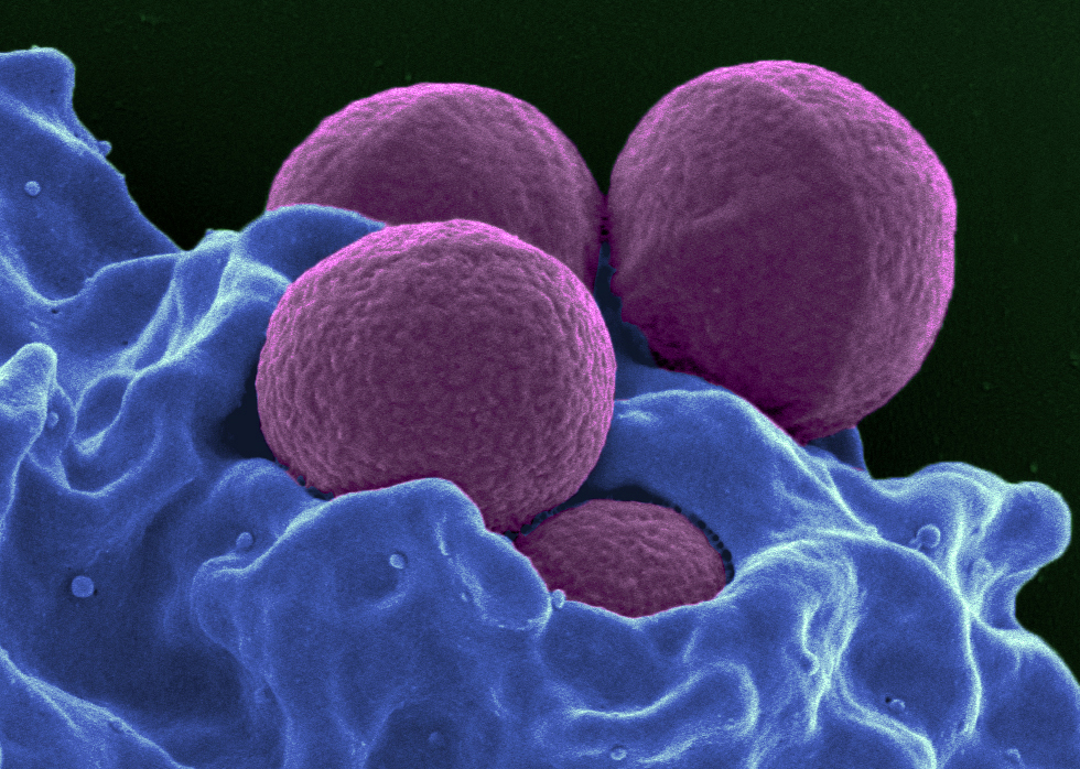 Common antimicrobials help patients recover from MRSA ...