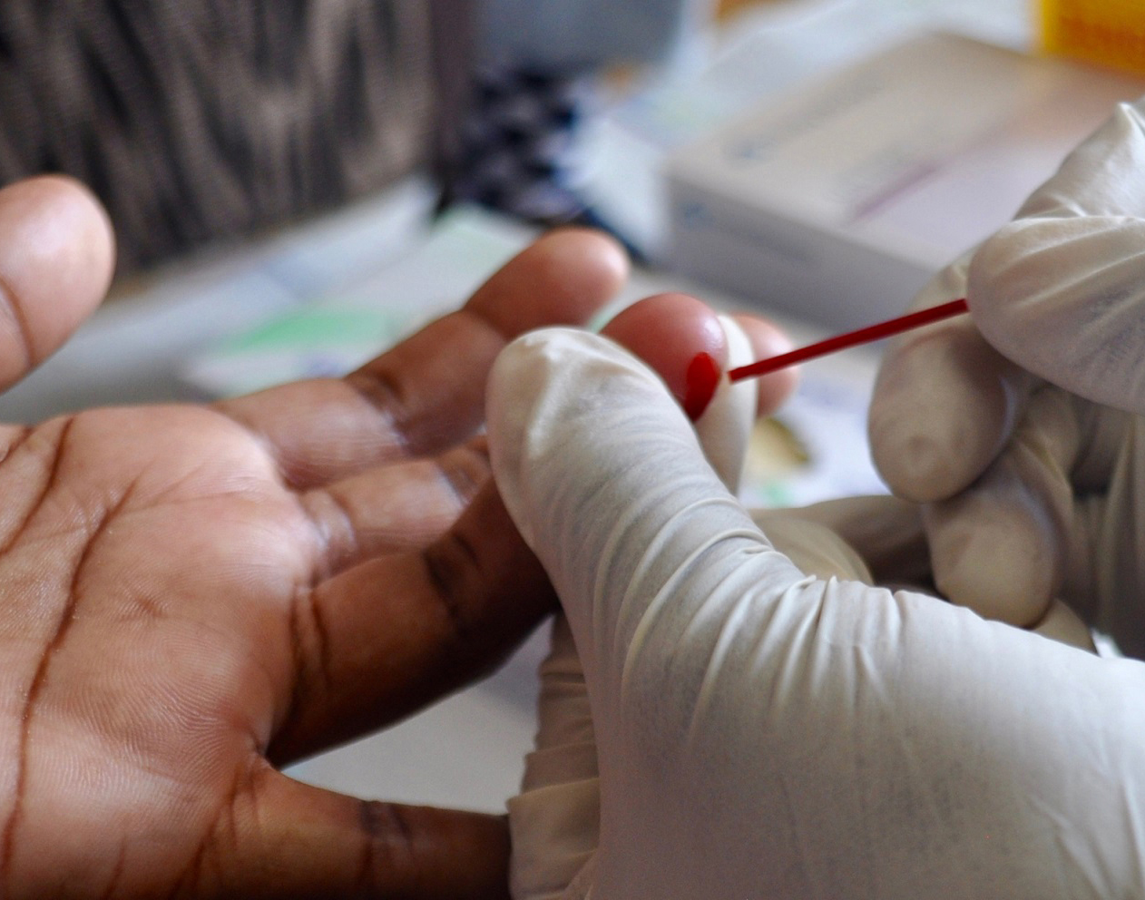 HIV Prevention Study Finds Universal test And Treat Approach Can 