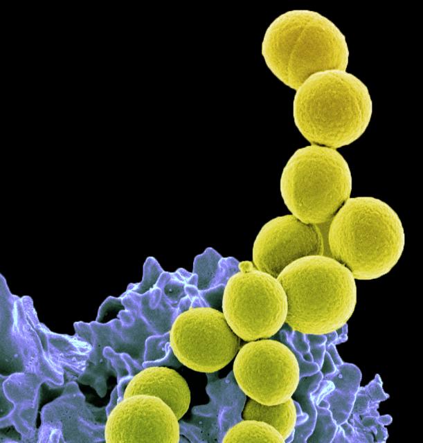 Staphylococcus aureus Infections