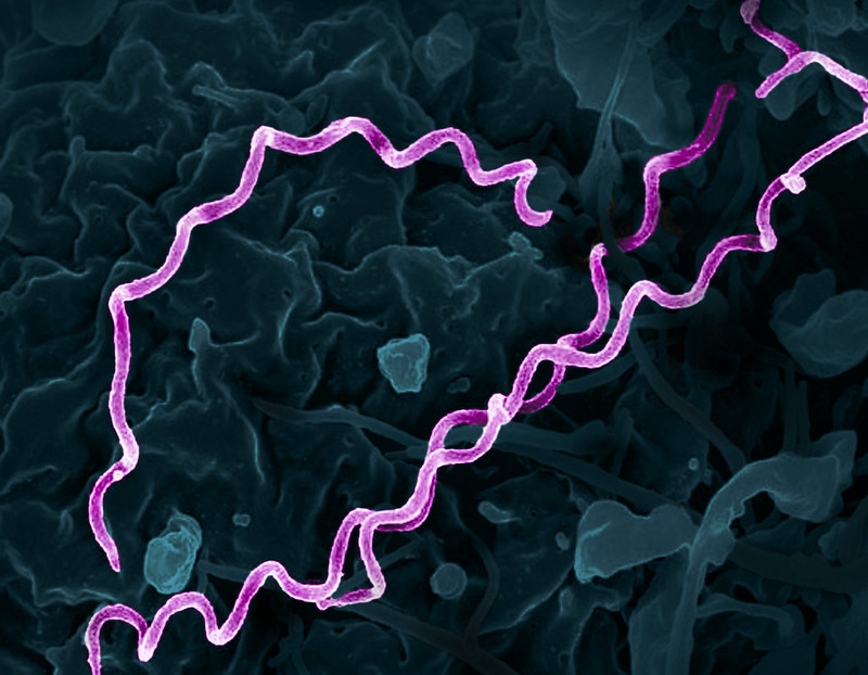 Treponema pallidum Bacteria (Syphilis)