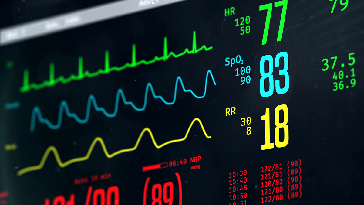 Image of a bedside ICU heart monitor.