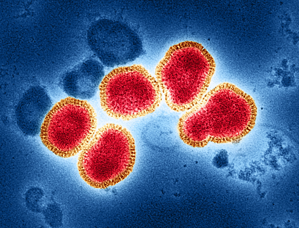 Influenza A viruses adapt shape in response to environmental pressures