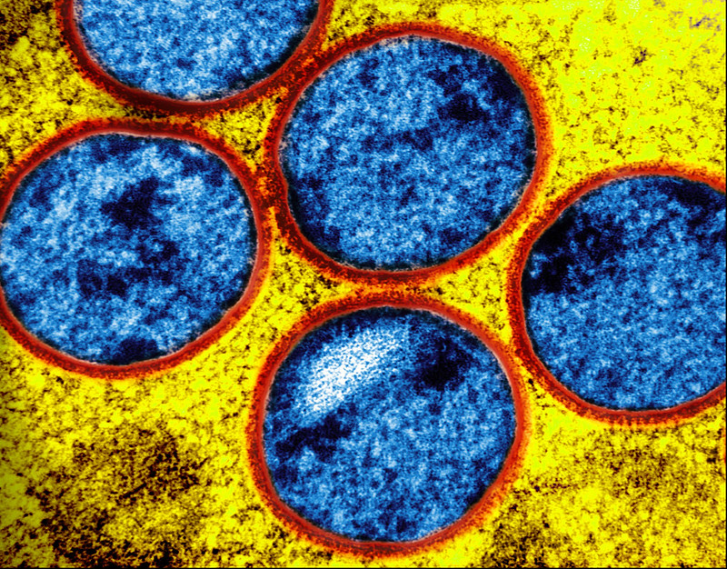 Tecovirimat is safe but ineffective as treatment for clade II mpox