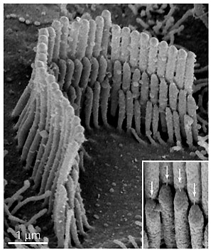 A Protein That Helps Turn Sound into Sense | National Institutes of ...