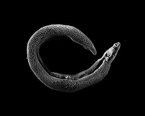 roundworm in humans skin