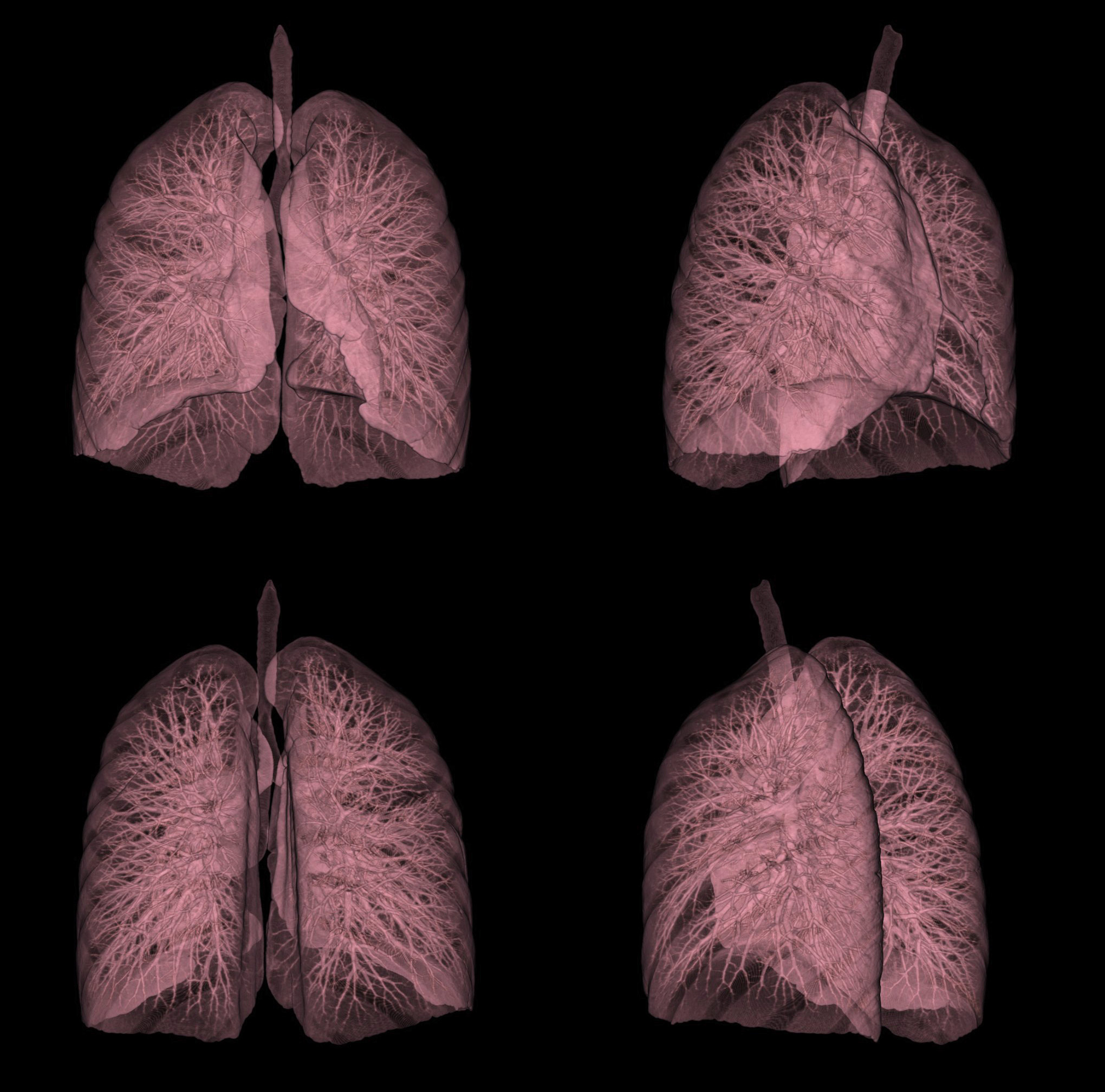 CT Screening Significantly Lung Mortality | Institutes Health (NIH)