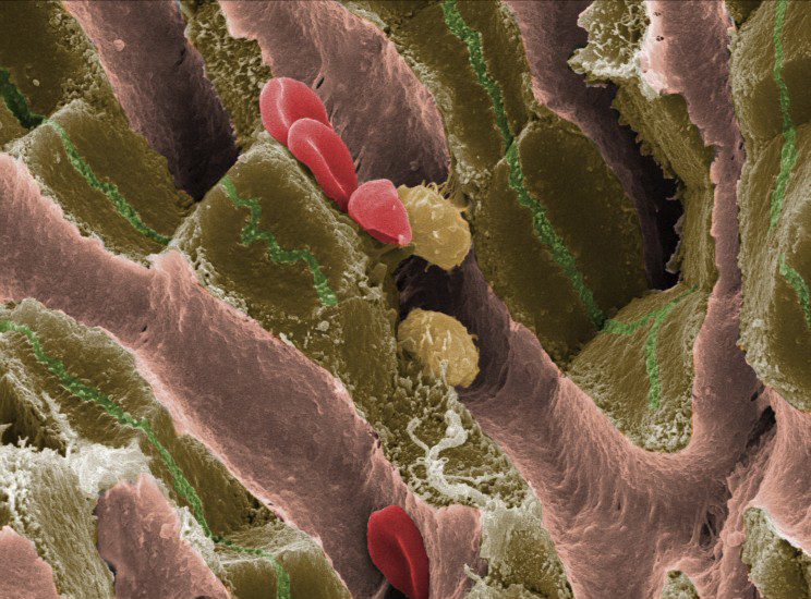 electron microscope images of human body