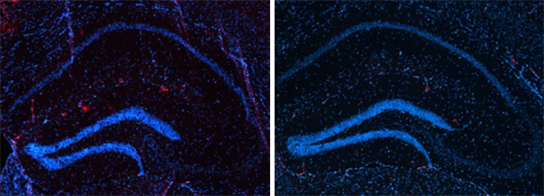 Drug Improves Alzheimer’s-like Condition In Mice | National Institutes ...