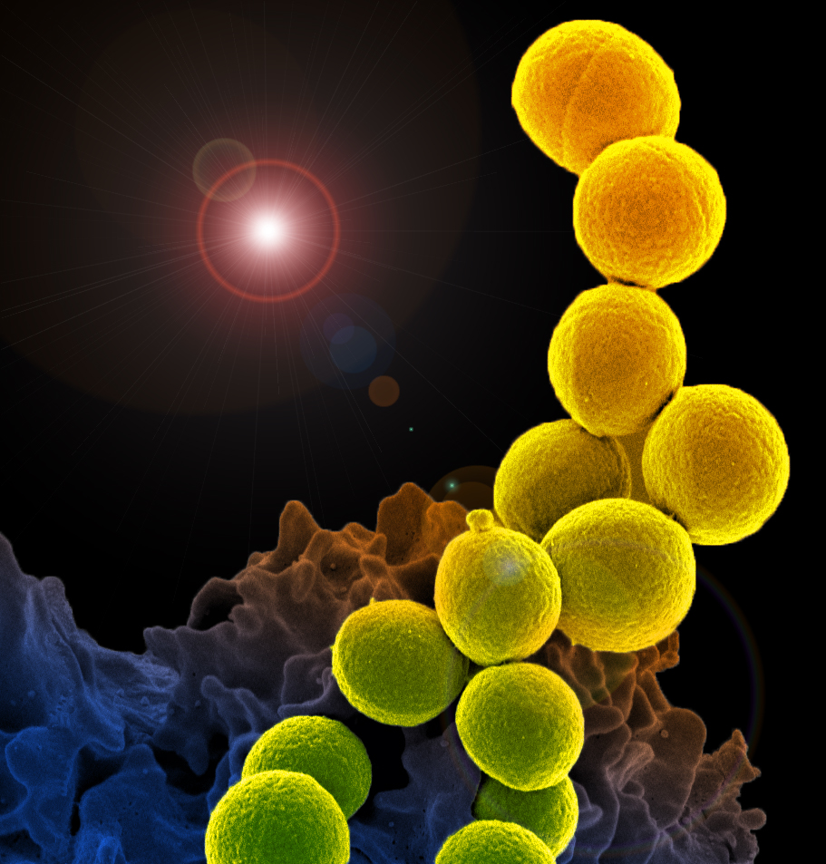 methicillin-resistant Staphylococcus aureus (MRSA) - News, Articles,  Whitepapers - Drug Target Review