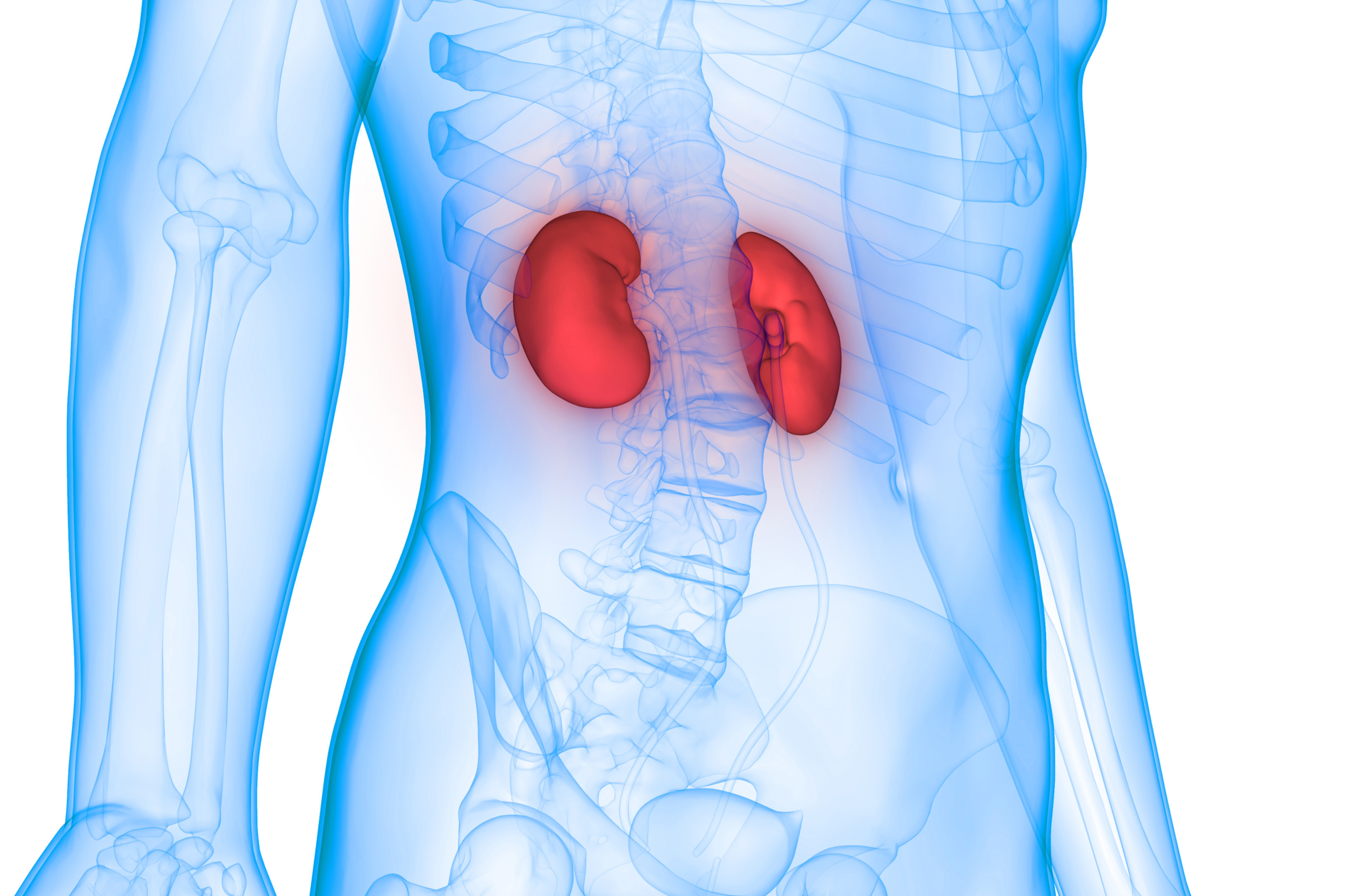 Gene Deletion Raises Risk Of Kidney Transplant Rejection National 