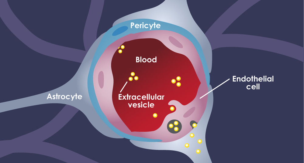 How cancer vesicles breach the blood-brain barrier