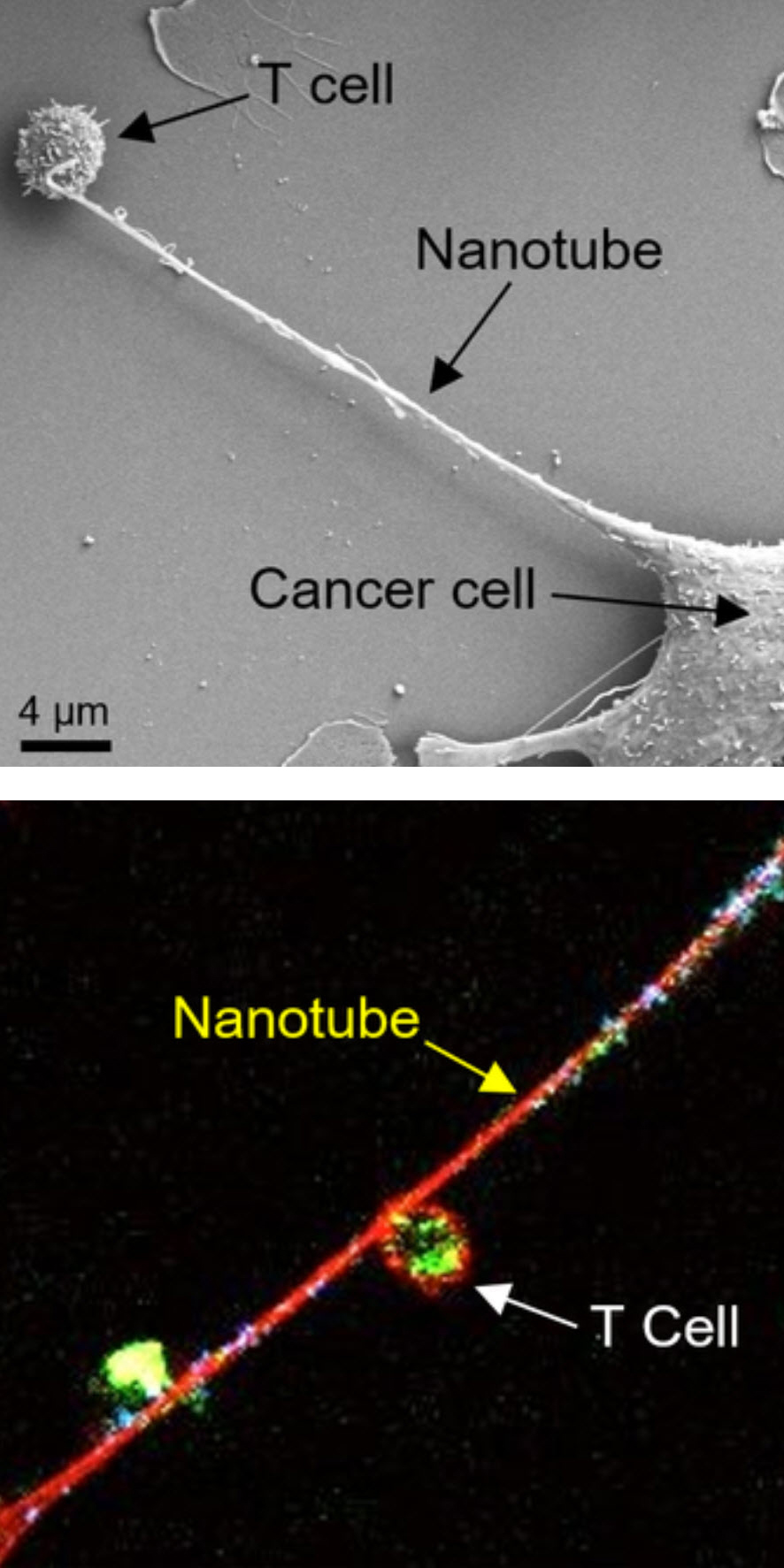 New Method of Killing Cancer Cells Developed