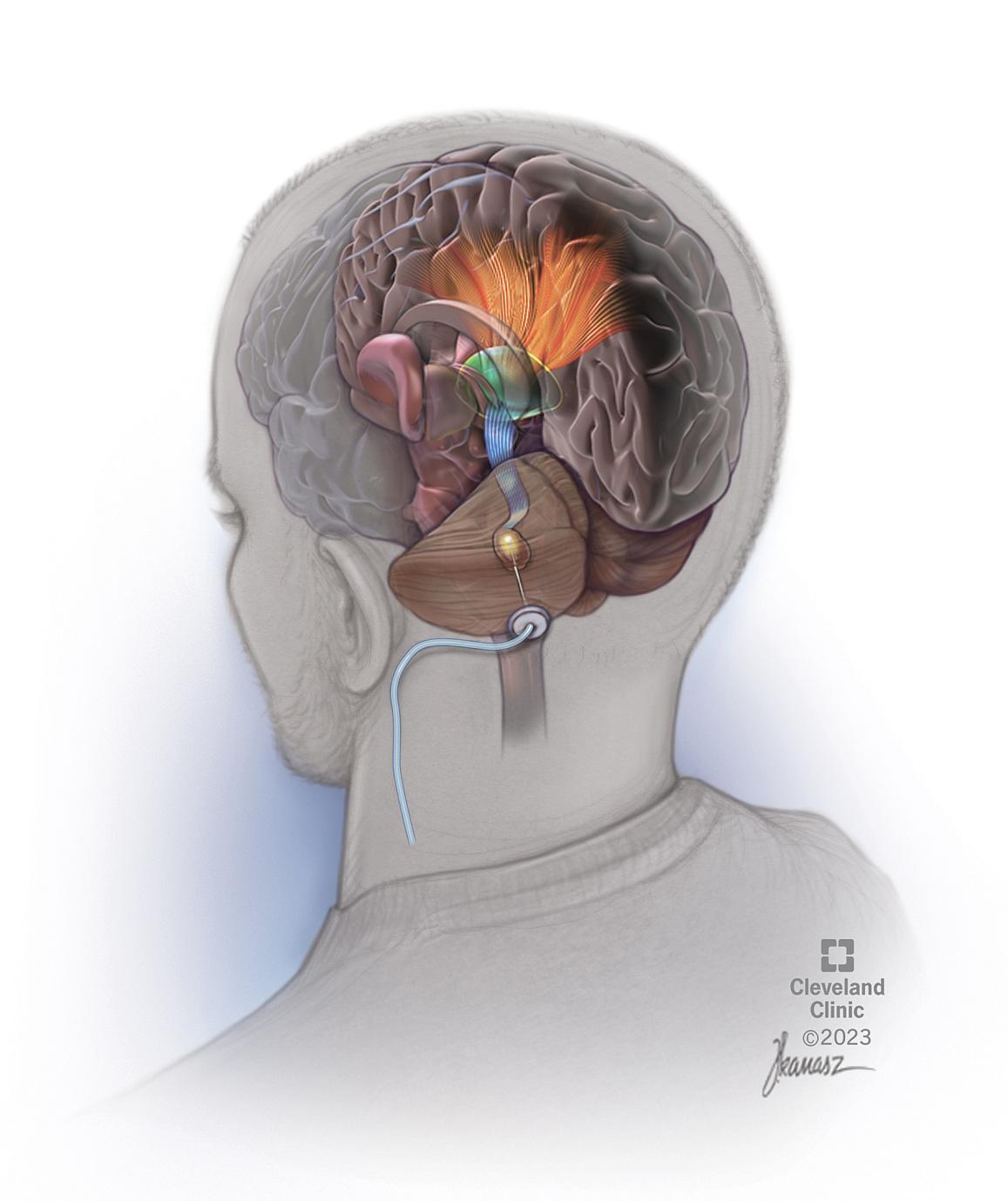 Upper limb nerves (Gray's illustrations), Radiology Case