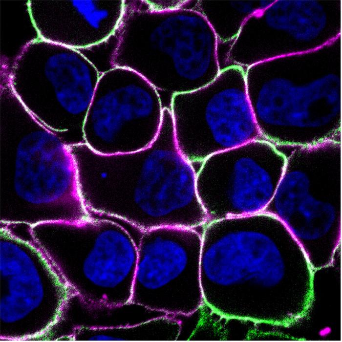 Human breast cancer cells.