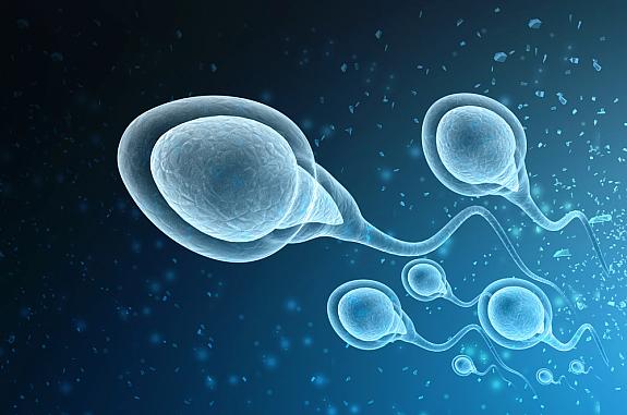 3D illustration of sperm cells swimming upward.