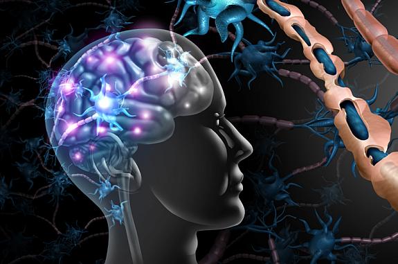 Illustration showing a brain artistically lit up from an immune attack and a close-up of damaged myelin around a nerve.