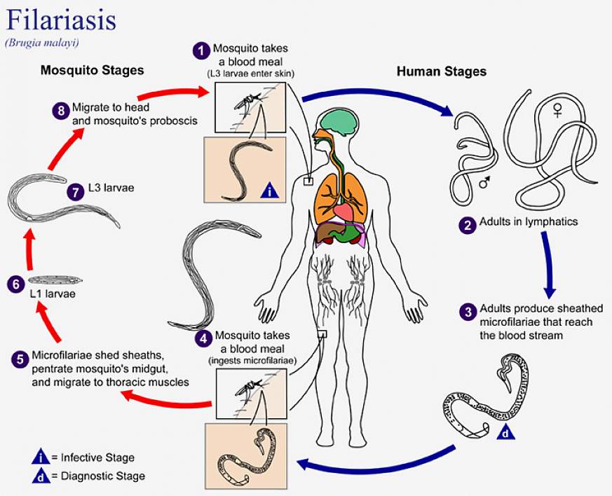 types of parasitic worms in humans