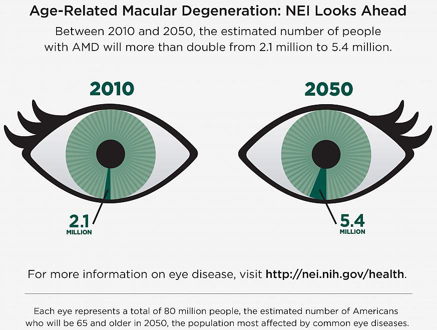 International Study Reveals New Genetic Clues To Age-related Macular ...