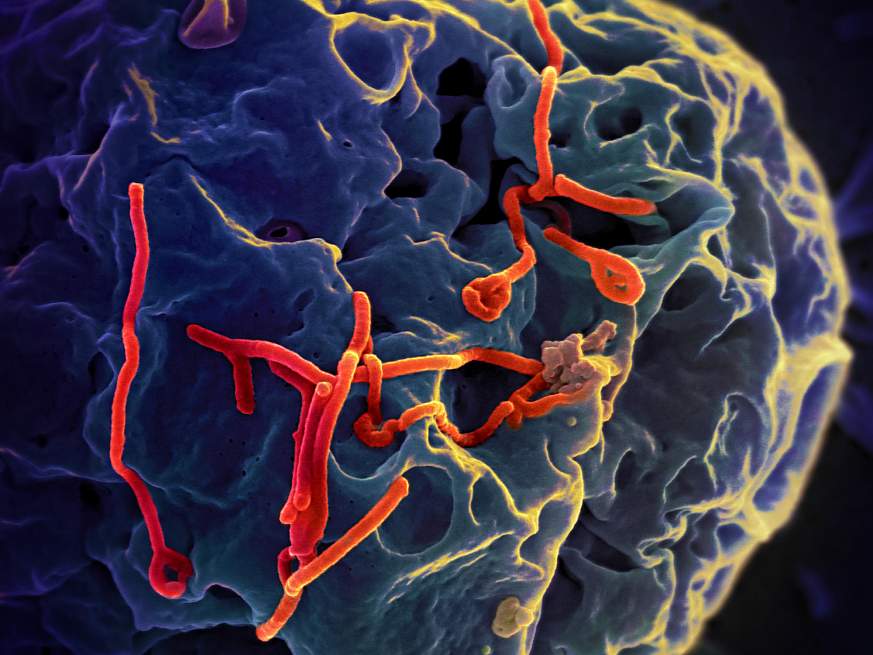 埃博拉病毒颗粒的显微图像