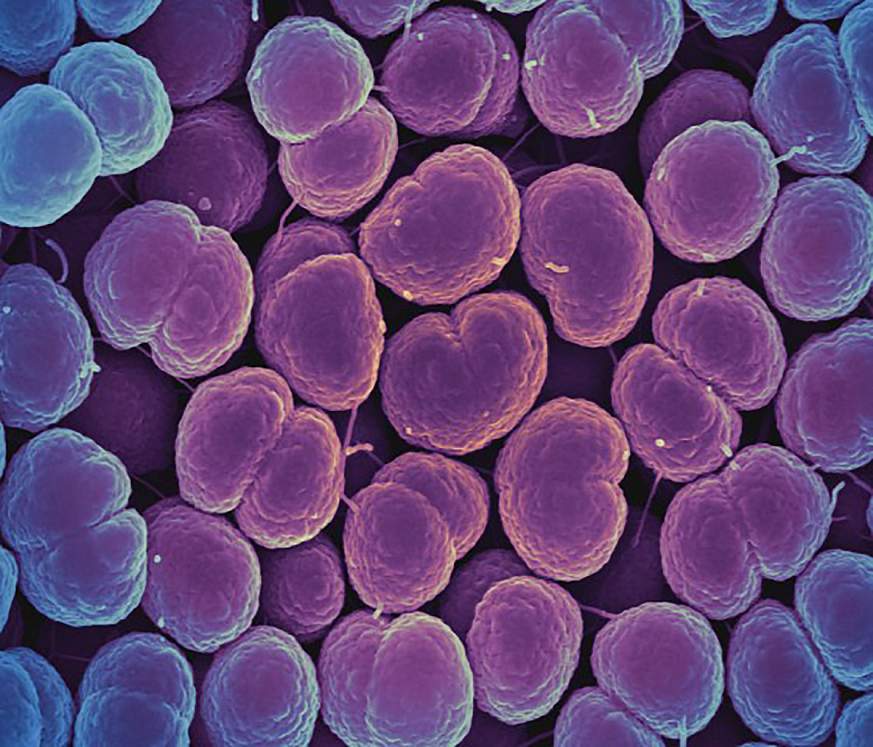 淋病奈瑟菌菌落形态图片
