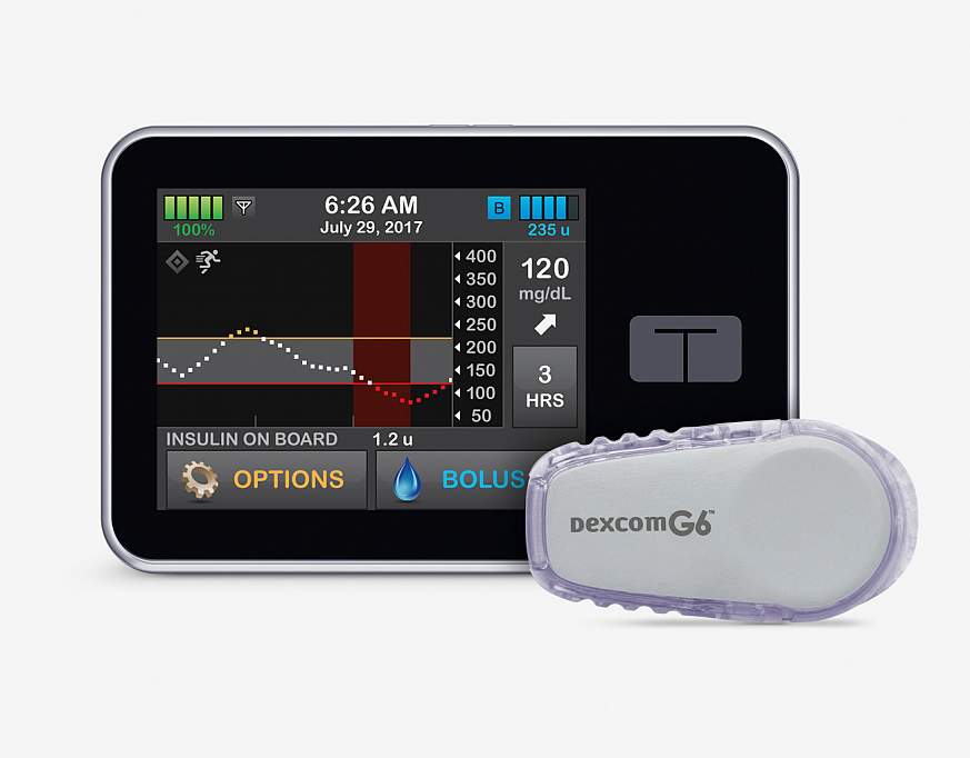 Artificial pancreas system better controls blood glucose levels