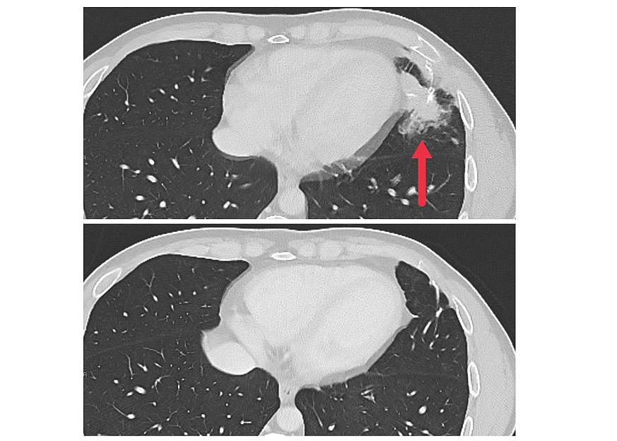 Scan tumors before and after treatment.