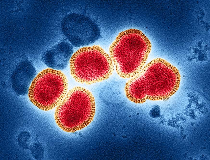 Virus de la grippe A (H3N2)