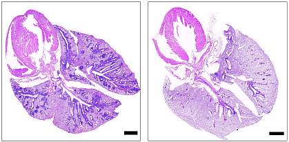 Cross-sections of lungs from mice with the gene deficiency that causes APS-1, showing damaged tissue in mice not administered ruxolitinib (left) and healthy tissue in mice administered ruxolitinib (right) Black bars represent 1 mm. 