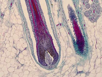 Human 2024 hair follicle