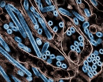 Electron micrograph shows long rods and circular cross-sections of virus particles.