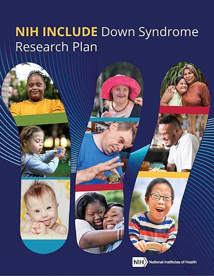 Down syndrome and cognitive development hot sale