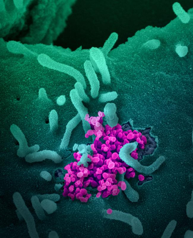 20200225-cov-2.jpg Novel Coronavirus SARS-CoV-2