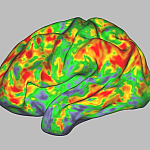 Image showing brain activity during a dose of psilocybin.