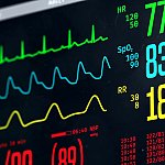 Image of a bedside ICU heart monitor.