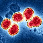 Influenza A Virus (H3N2)