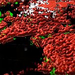 Screenshot of video describing how the complexity of tumors has been revealed in 3D.