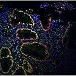 Immunofluorescence signal is strong in the epithelial cells surrounding colon spaces.