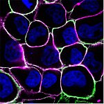 Human breast cancer cells.