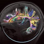 特定大脑电路的接线图，现在称为人脑中的“连接体”。