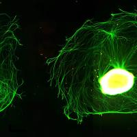 Two dorsal root ganglion neurons labelled to show the rounded cell bodies with numerous long, thin projections.