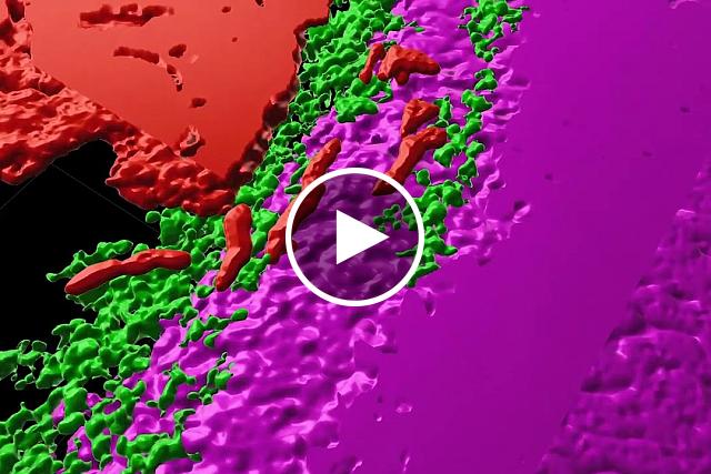 Screenshot of video describing how the complexity of tumors has been revealed in 3D.